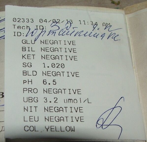 Minu uriini analüüs tuleneb enne Femixali